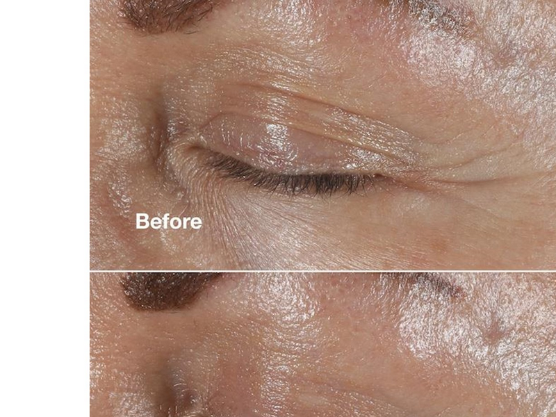 Clinique Smart Clinical Repair Wrinkle Correcting Eye Cream - 15ml
