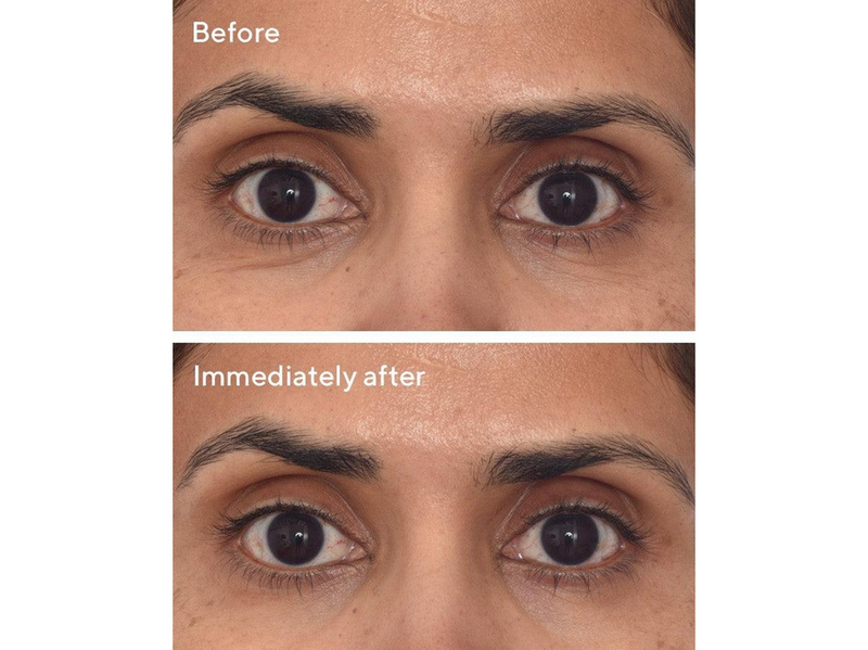 Murad Retinol Youth Renewal Eye Masks