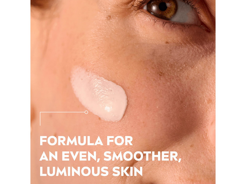 Nivea LUMINOUS 630 Post-Acne Marks Serum – 30 ml