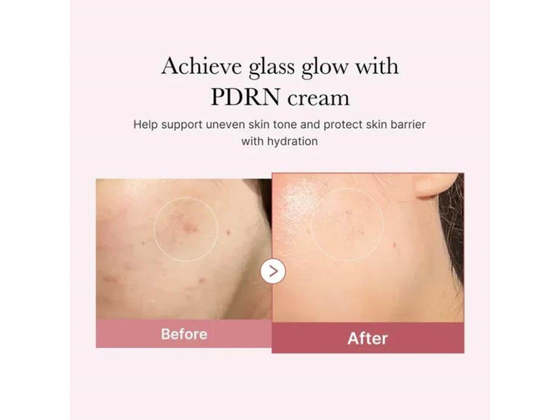 Medicube PDRN Pink Hyaluronic Moisturizing Cream 50ml