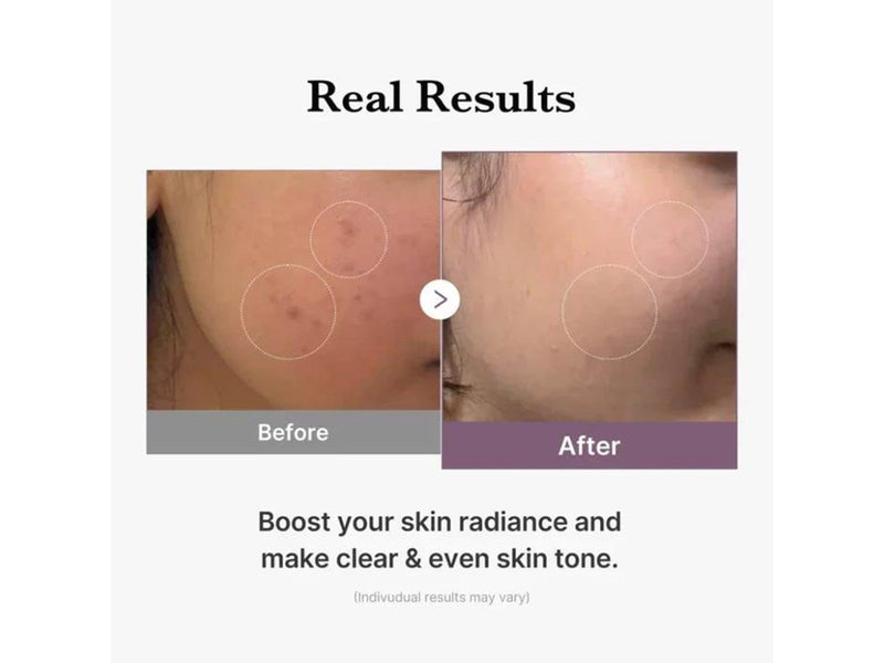 Medicube AGE-R Glutathione Glow Toner 140ml