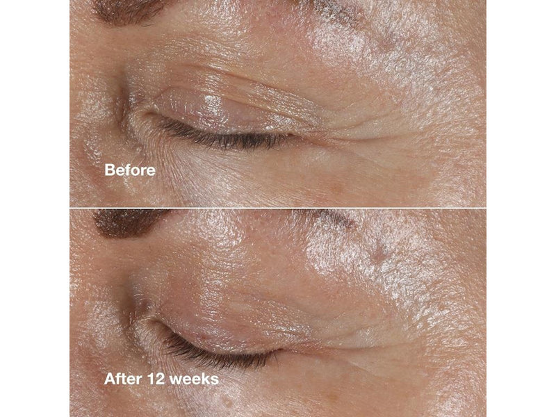 Clinique Smart Clinical Repair Wrinkle Correcting Eye Cream - 15ml
