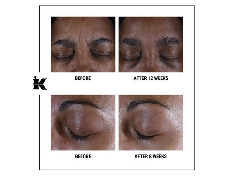 Kiehl's Super Multi-Corrective Eye Zone Treatment 14 ml