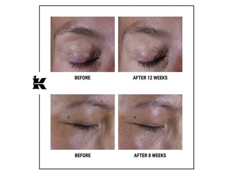 Kiehl's Super Multi-Corrective Eye Zone Treatment 14 ml