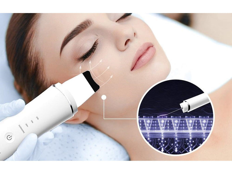 Anlan Ultrasonic Cleansing 01-ACPJ32-02A (white)