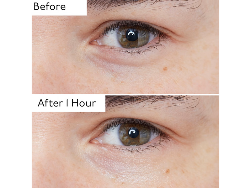 By Terry Hyaluronic Global Eye Serum - Refill