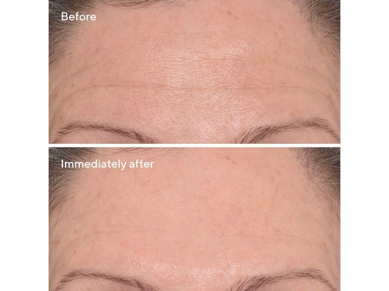 Murad Resurgence Targeted Wrinkle Corrector
