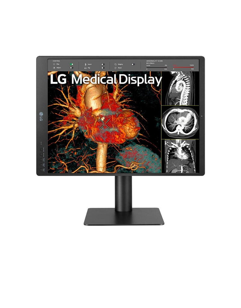 LG 21HQ513D-B Diagnosemonitor 54,1 cm (21.3')