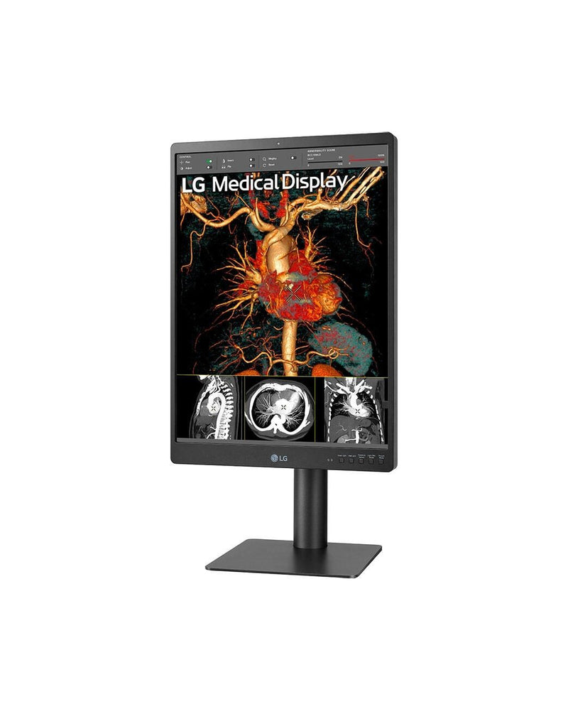 LG 21HQ513D-B Diagnosemonitor 54,1 cm (21.3')