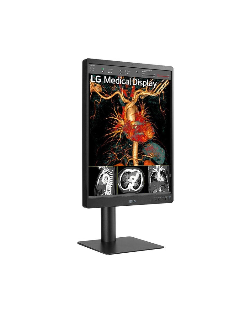 LG 21HQ513D-B Diagnosemonitor 54,1 cm (21.3')