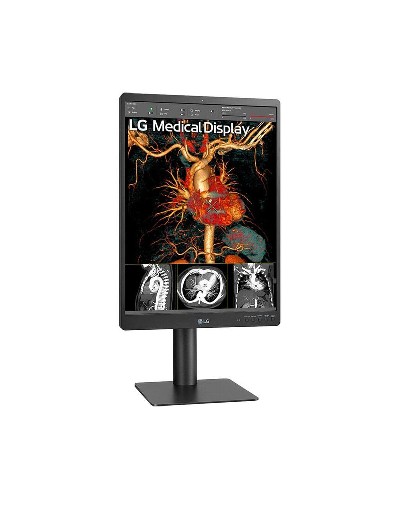 LG 21HQ513D-B Diagnosemonitor 54,1 cm (21.3')