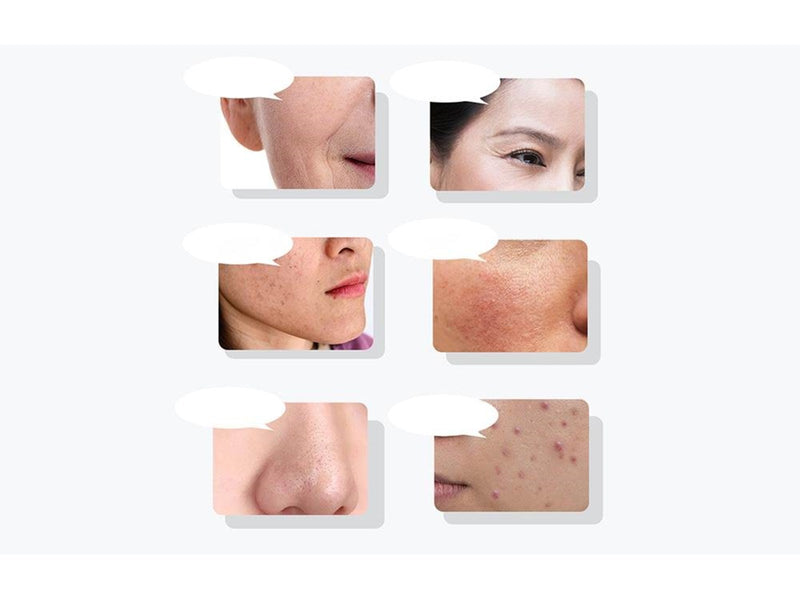 Anlan Ultrasonic facial massager with light therapy