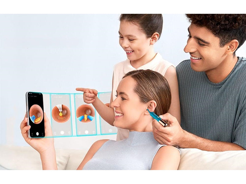 Bebird Earsight Ultra Camera Otoscope