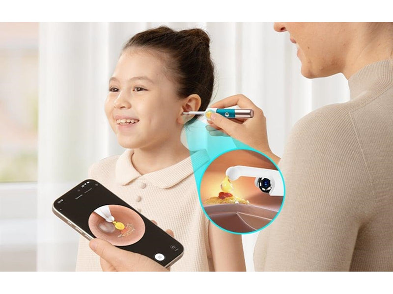 Bebird Earsight Ultra Camera Otoscope