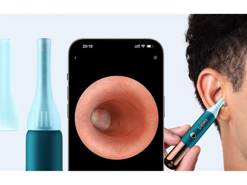Bebird Earsight Ultra Camera Otoscope