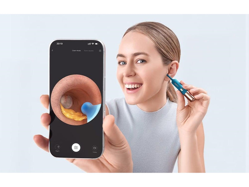 Bebird Earsight Ultra Camera Otoscope