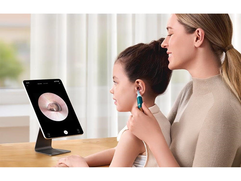 Bebird Earsight Ultra Camera Otoscope