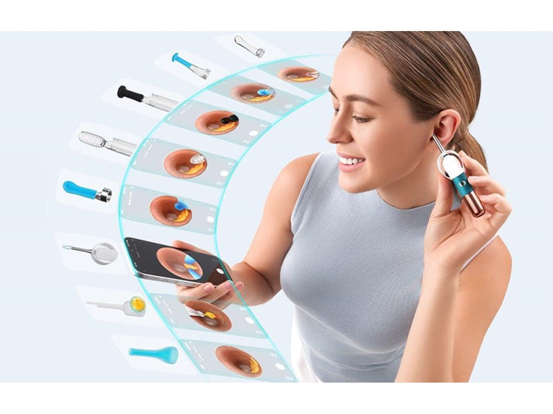 Bebird Earsight Ultra Camera Otoscope