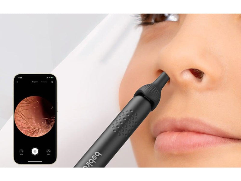 Bebird Tip Kit R1 M9s T15 D3 Pro Otoscopes