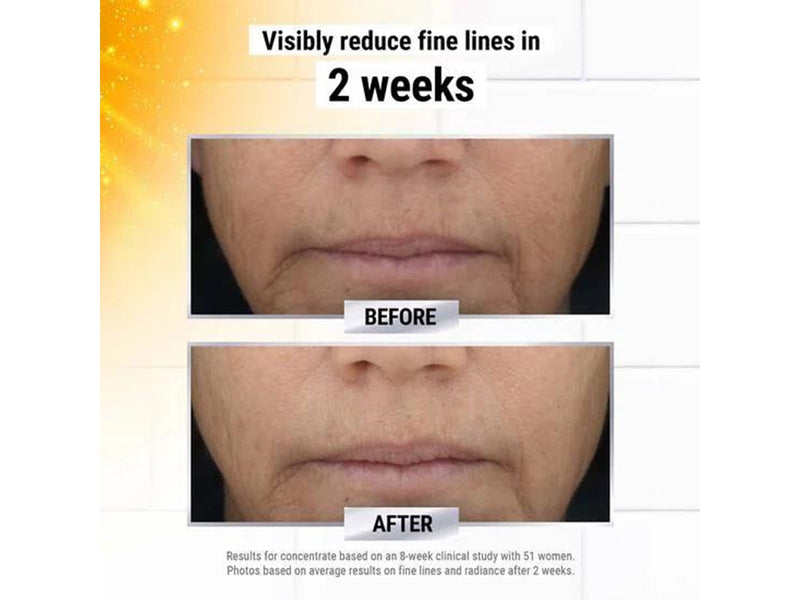 Kiehl's Powerful-Strength Vitamin C Serum 100 ml